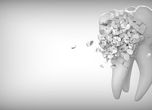 Broken Teeth